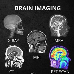 Pet Scan Vs Mri Psychology