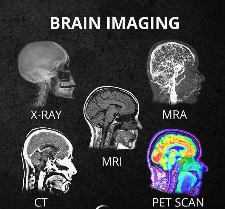 Pet Scan Vs Mri Psychology